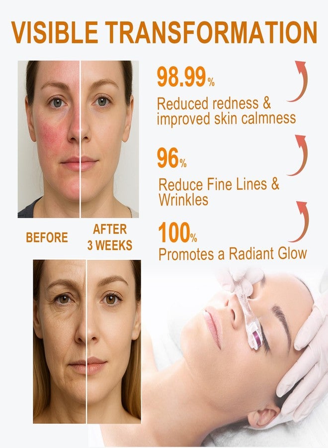 morovan Salmon DNA PDRN Face Serum: Recovery Serum with EGF Peptide Collagen Growth Factor for Sensitive & Post-Microneedling - Soothe Redness & Repair Skin Barrier in 72 Hours - 1 Fl Oz - Image 4